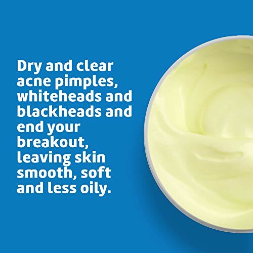 Cream for acne treatment with text about benefits.