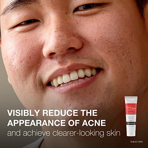 Smiling person with acne treatment product displayed